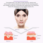 V Shape Face Mask Double Chin Reduction Slimming Patch –  Face Lift Tightening